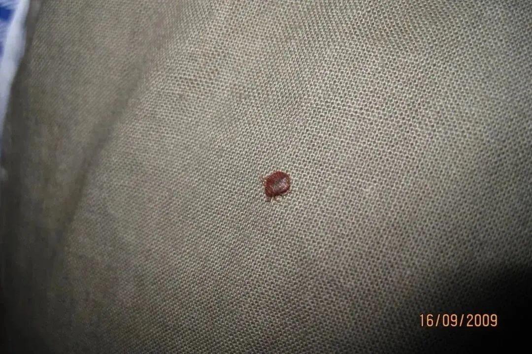 灭臭虫知识_灭臭虫效果最好的药_灭臭虫神器